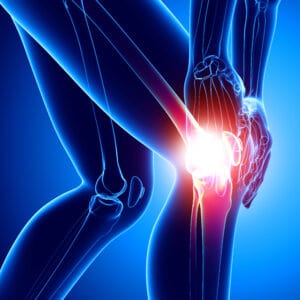 What Can You Do For Joint Pain?